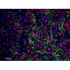 Human Cardiac Microvascular Endothelial Cells (HCMEC)